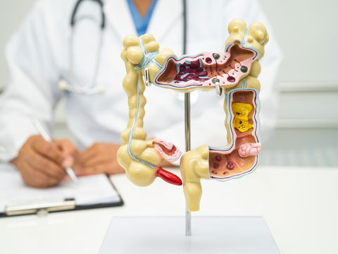 Morbus Crohn Lebenserwartung: Wie alt können Betroffene werden?