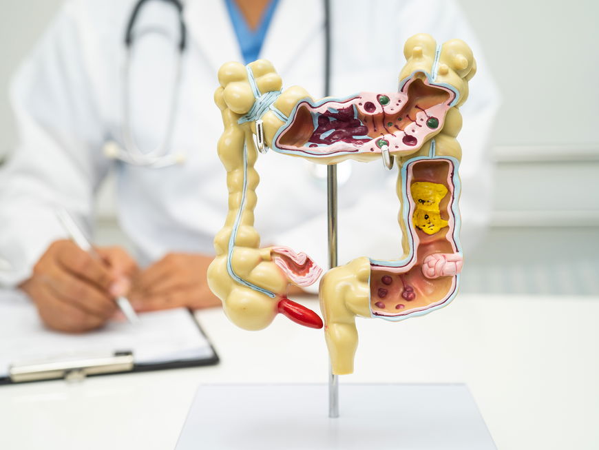 Arzt sitzt vor anatomischem Modell des Darms