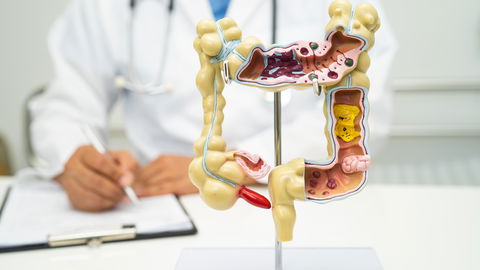 Morbus Crohn Lebenserwartung: Wie alt können Betroffene werden?