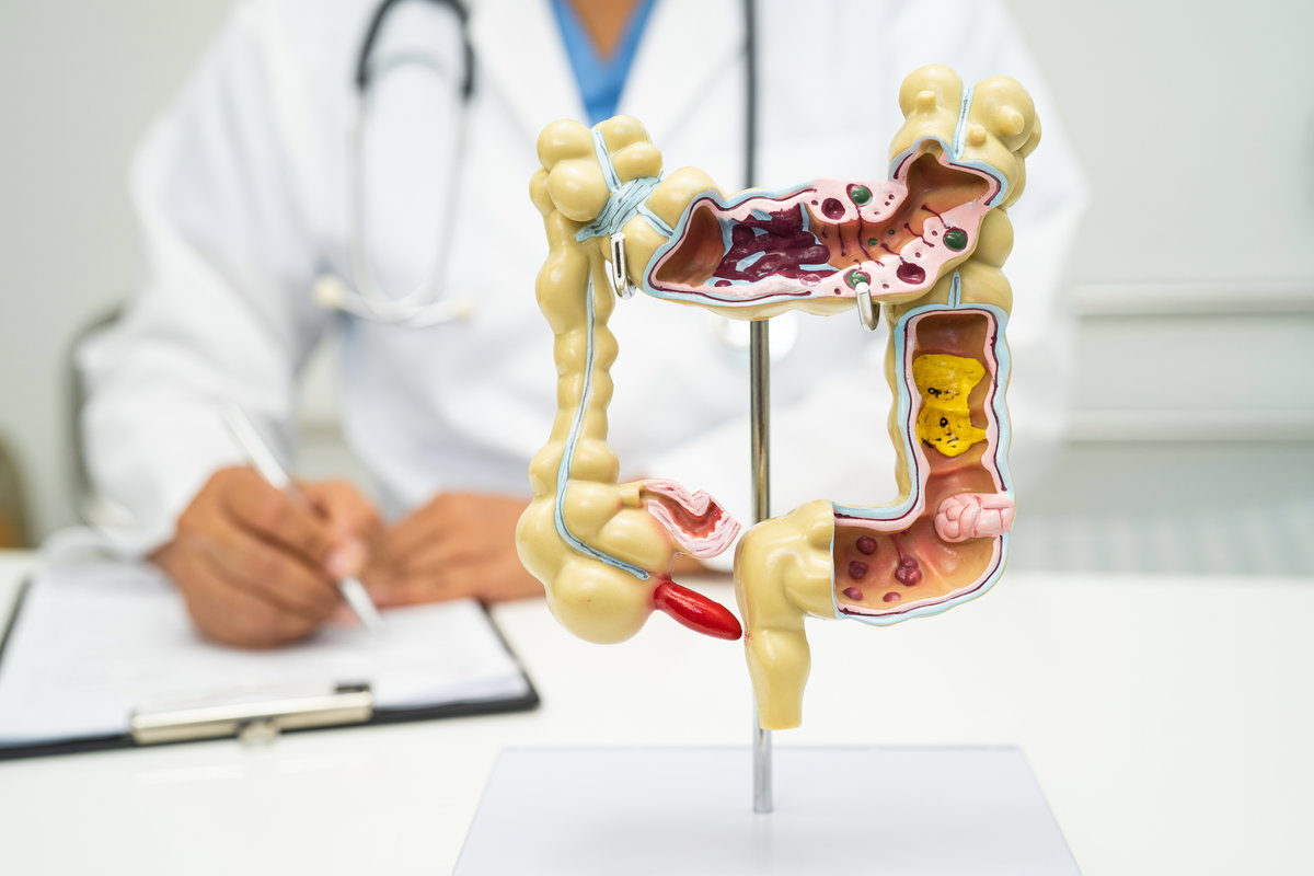 Arzt sitzt vor anatomischem Modell des Darms