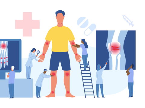 Arthrose: Symptome, Ursachen und Behandlung der Gelenkerkrankung