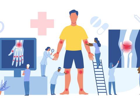 Arthrose: Symptome, Ursachen und Behandlung der Gelenkerkrankung