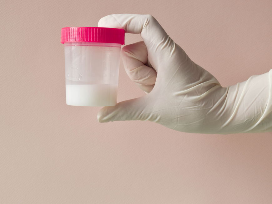 Hand hält Spermaprobe hoch