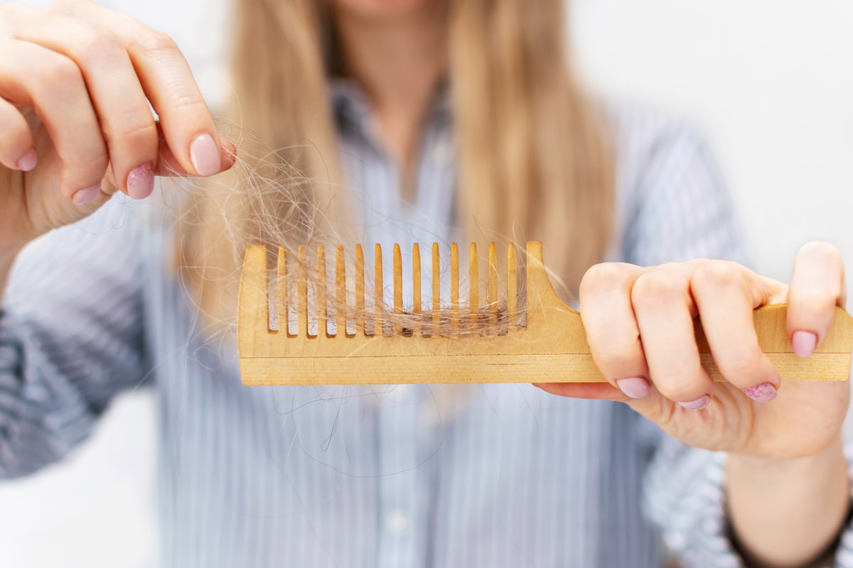 Frau hat viele Haare in der Haarbürste