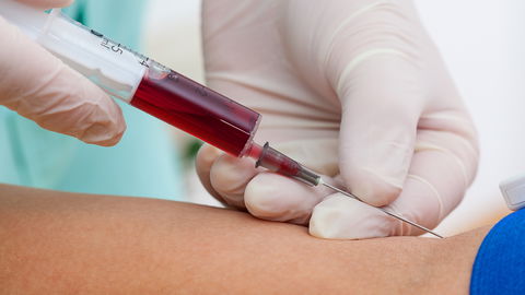 Hilfe bei Asthma: Was die Eigenbluttherapie verspricht