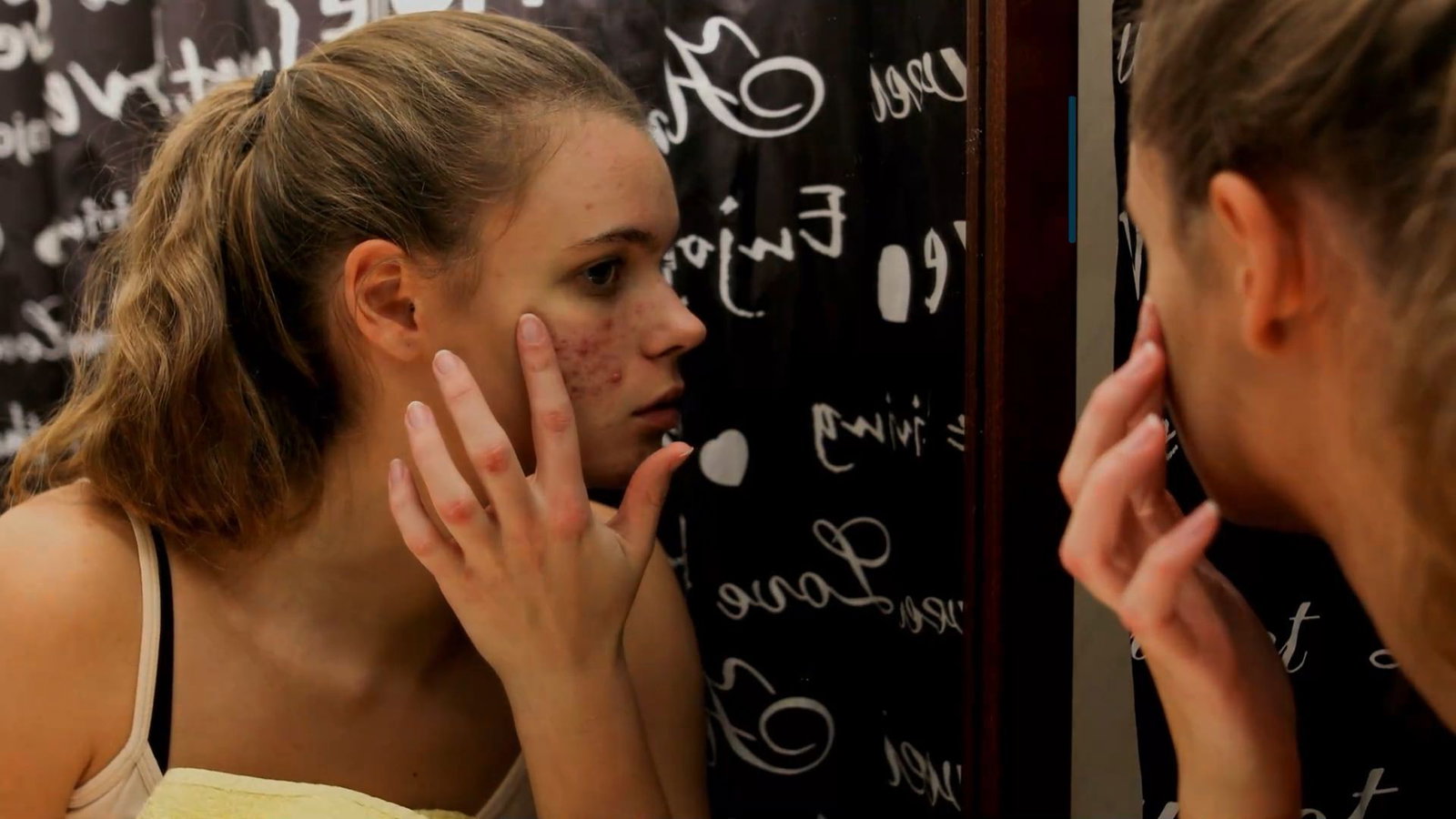 Zu viel Testosteron bei Frauen: Das müssen Sie zu Ursachen und Behandlung wissen