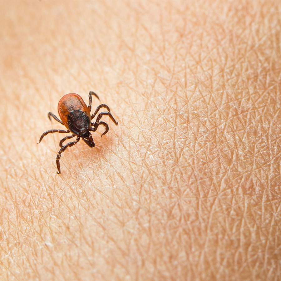 Borreliose vom Biss der Zecke