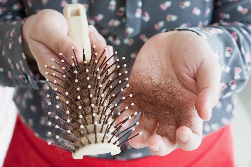 Frau hält ein Haarknäuel und ihre Bürste in der Hand.