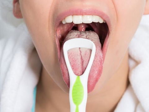 Candida-Infektion Soor: Das sollten Sie über die Pilzinfektion wissen