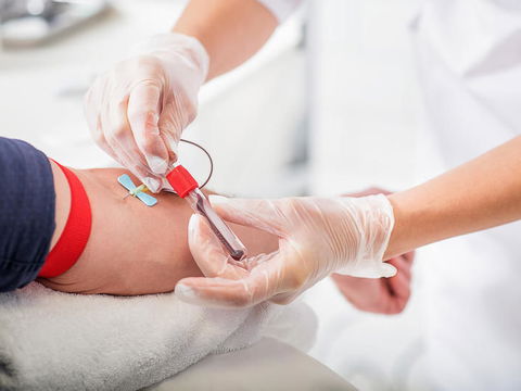 Großes Blutbild: Diese Werte werden oft übersehen
