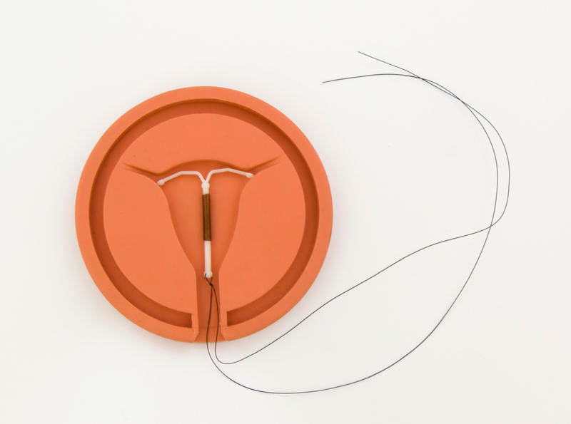 Kupferspirale