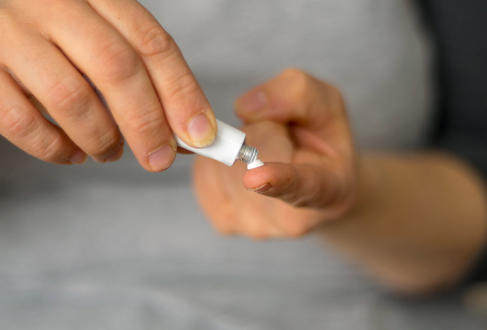 So hilft Zinksalbe gegen unreine Haut und Pickel