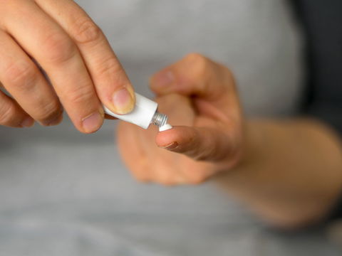 So hilft Zinksalbe gegen unreine Haut und Pickel